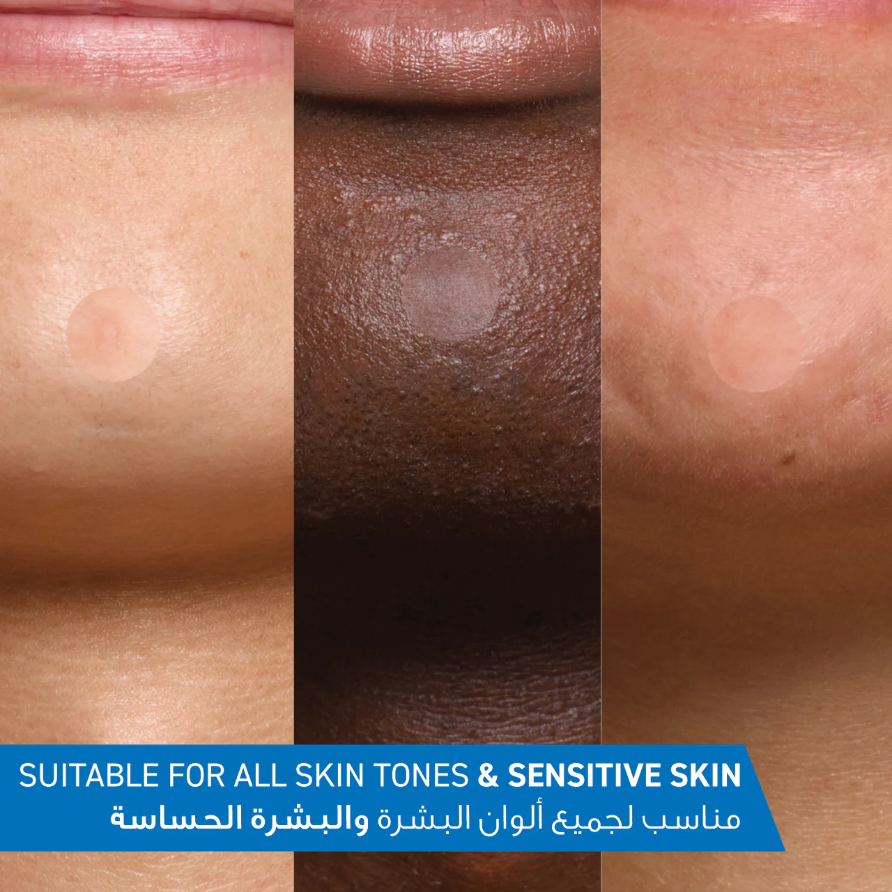 Blemish Barrier Patches - Image 7