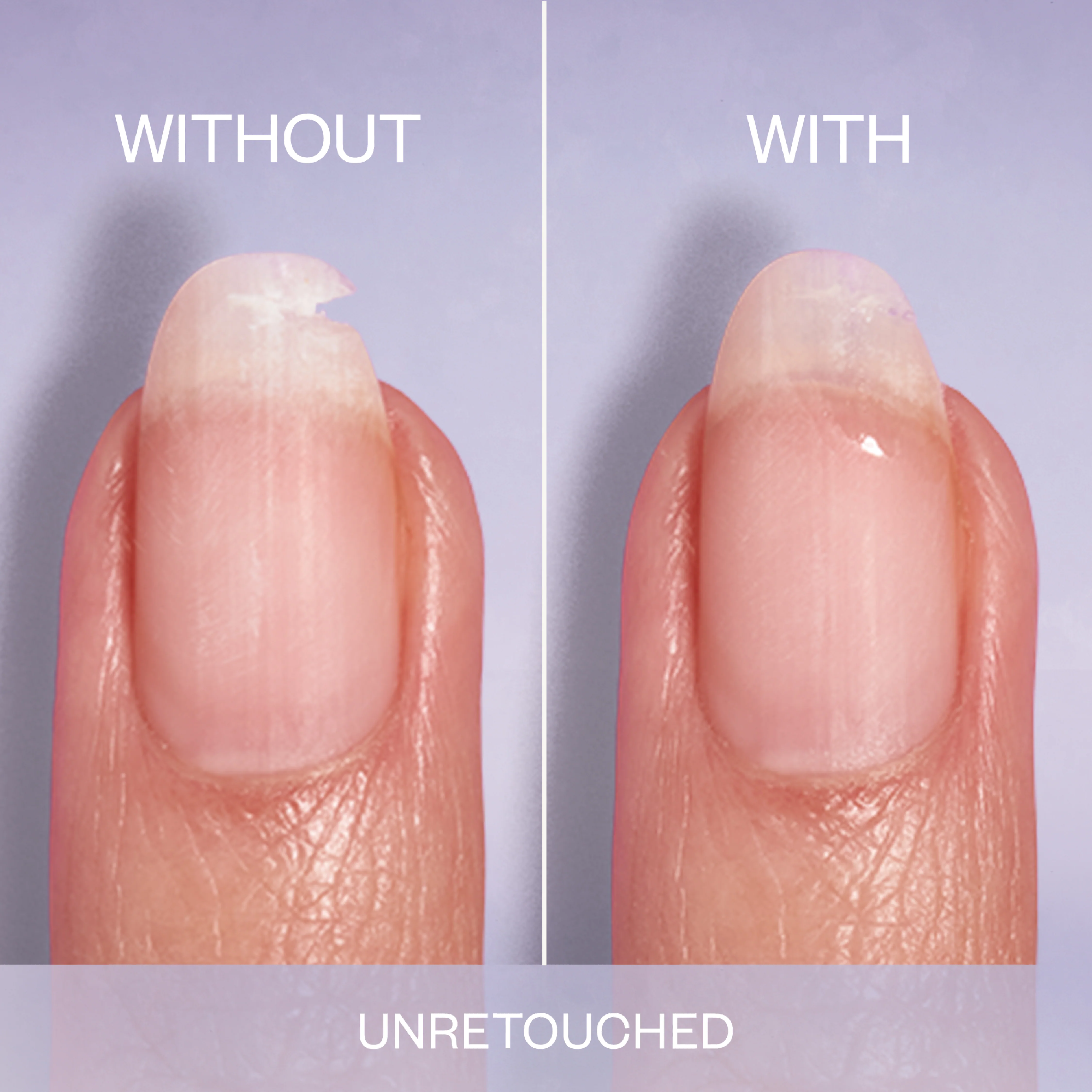Essie Break Fix Liquid Nail Care and Treatment Patch - Image 4