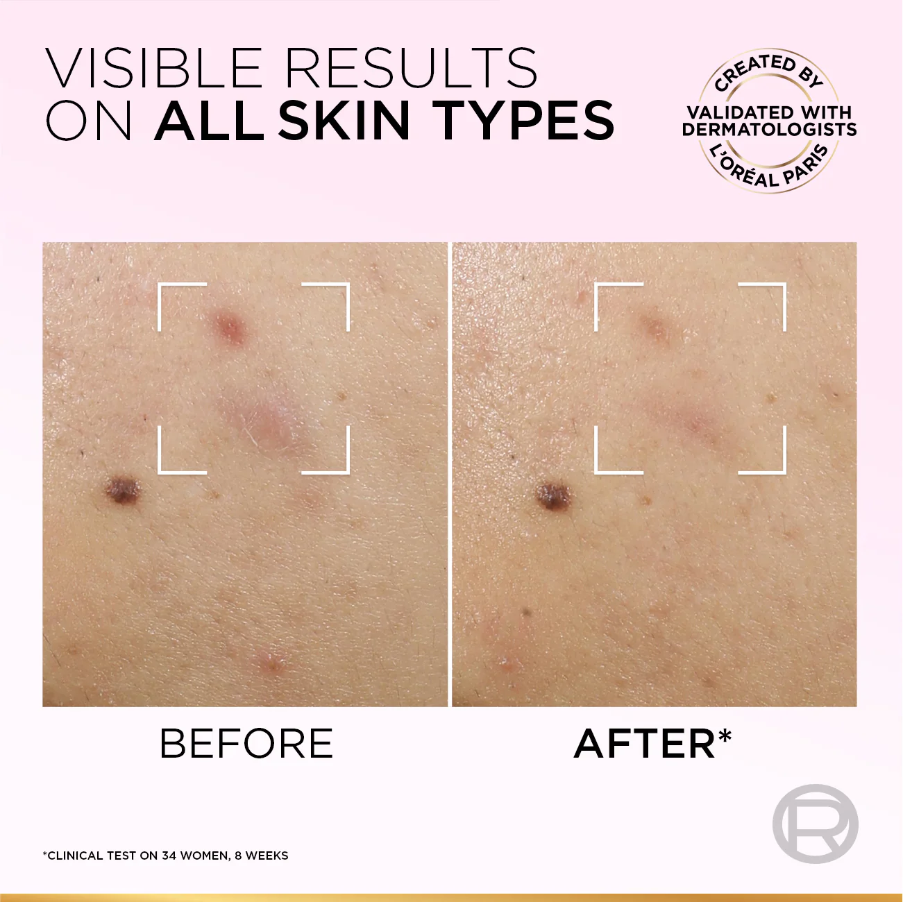 Glycolic-Bright Anti-Dark Spot Exfoliant Peel 15% AHA + BHA + PHA + Niacinamide - Image 7