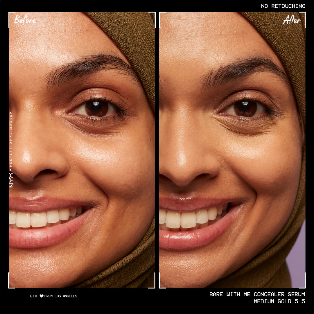 Bare With Me Concealer Serum, For Face & Body, Up to 24HR Hydration For Skin - Image 19