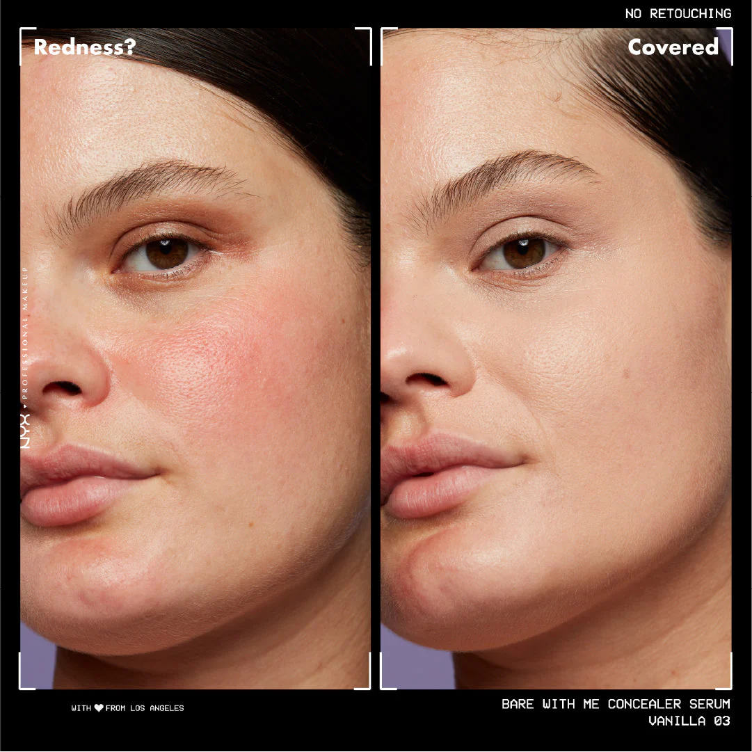 Bare With Me Concealer Serum, For Face & Body, Up to 24HR Hydration For Skin - Image 7